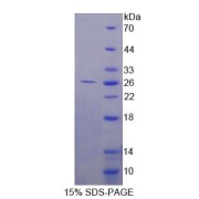 SDS-PAGE analysis of Human FBLN3 Protein.