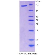 SDS-PAGE analysis of Rat NFIX Protein.