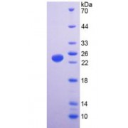 SDS-PAGE analysis of Human TRPV1 Protein.