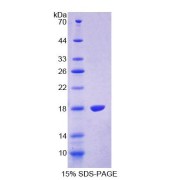 SDS-PAGE analysis of Human TRPV3 Protein.