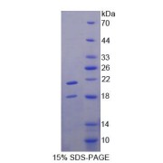 SDS-PAGE analysis of Human TRPV6 Protein.