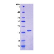 SDS-PAGE analysis of Human SRI Protein.