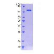 SDS-PAGE analysis of Human SPINT2 Protein.