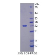 SDS-PAGE analysis of Mouse PHF8 Protein.