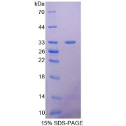 SDS-PAGE analysis of Mouse SDHA Protein.