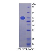 SDS-PAGE analysis of Human YWHAq Protein.