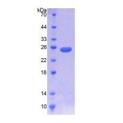 SDS-PAGE analysis of Human NOMO1 Protein.