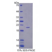 SDS-PAGE analysis of Rat IL1F9 Protein.