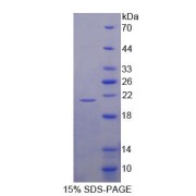 SDS-PAGE analysis of Human RPL23A Protein.