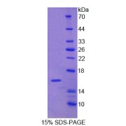 SDS-PAGE analysis of Human NARF Protein.