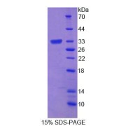 SDS-PAGE analysis of Mouse ROM1 Protein.