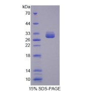 SDS-PAGE analysis of Human MUT Protein.