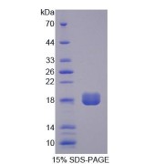 SDS-PAGE analysis of Human PPAP2B Protein.