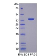 SDS-PAGE analysis of Human CTP Protein.