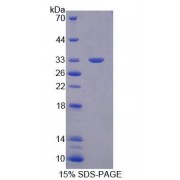 SDS-PAGE analysis of Human TBCB Protein.