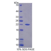 SDS-PAGE analysis of Human PFDN2 Protein.