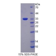 SDS-PAGE analysis of Human EIF3M Protein.