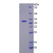 SDS-PAGE analysis of Mouse TRIM5 Protein.