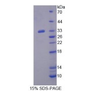 SDS-PAGE analysis of Human XPO6 Protein.