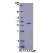 SDS-PAGE analysis of Human CAPN11 Protein.