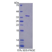 SDS-PAGE analysis of Mouse CASC1 Protein.