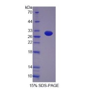 SDS-PAGE analysis of Rat GFM2 Protein.