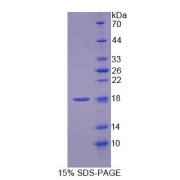 SDS-PAGE analysis of Rat MCEE Protein.