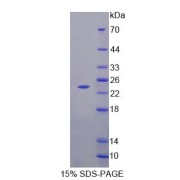 SDS-PAGE analysis of Human NCALd Protein.