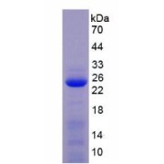 SDS-PAGE analysis of Mouse MMP1 Protein.