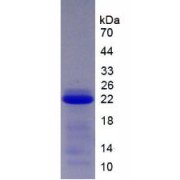 SDS-PAGE analysis of Human SCCA2 Protein.