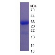 SDS-PAGE analysis of recombinant Human RNASE2 protein.