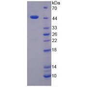 SDS-PAGE analysis of recombinant Human LMTK3.