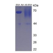 SDS-PAGE analysis of Amyloid Beta Peptide 1-40 Protein (BSA).