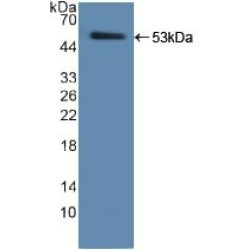 Human Neutrophil Elastase / ELA2 (ELANE) Protein (Active)