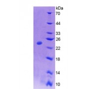 Mouse Colony Stimulating Factor 1, Macrophage (MCSF) Protein (Active)