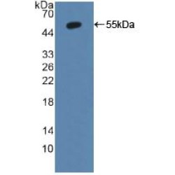 Human Cytochrome P450 1A2 (CYP1A2) Protein (Active)