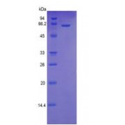 Human TNF Receptor Superfamily Member 6 / CD95 / TNFRSF6 (FAS) Protein (Active)