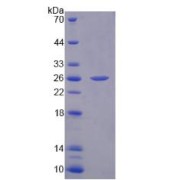 Human Fibronectin (FN) Protein (Active)