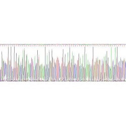 Human Histidine Rich Glycoprotein (HRG) Protein (Active)