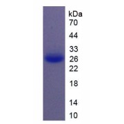 Human Interleukin 11 (IL11) Protein (Active)