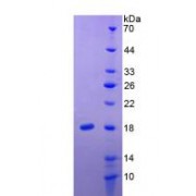 Human Interleukin 24 (IL24) Protein (Active)