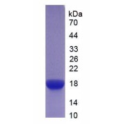 Mouse Interleukin 6 Receptor (IL6R) Protein (Active)