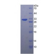 Human Tubulin Beta (TUBB) Protein (Active)