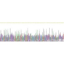 Human Tubulin Beta (TUBB) Protein (Active)