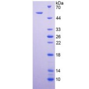 Human Tumor Necrosis Factor Receptor Superfamily Member 10B / DR5 (TNFRSF10B) Protein (Active)