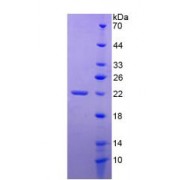 Human Tumor Necrosis Factor Receptor Superfamily, Member 14 (TNFRSF14) Protein (Active)