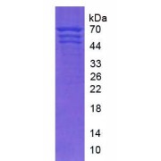 SDS-PAGE analysis of native Human Fibrinogen (FG) Protein