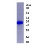 SDS-PAGE analysis of recombinant Pig Somatotropin (GH1) Protein.