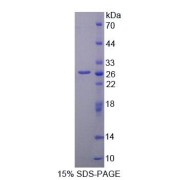 SDS-PAGE analysis of recombinant Mouse Matrix Metalloproteinase 2 (MMP2) Protein.