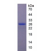 SDS-PAGE analysis of recombinant Rat Carcinoembryonic Antigen (CEA) Protein.